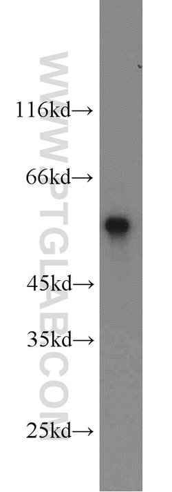 SMAD2 Rabbit anti-Human, Mouse, Rat, Polyclonal, Proteintech:Antibodies:Primary