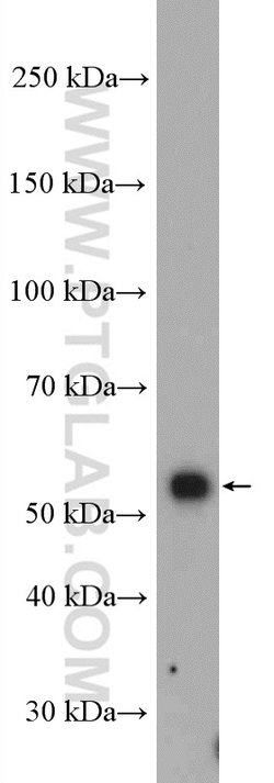 SMAD2 Rabbit anti-Human, Mouse, Rat, Polyclonal, Proteintech:Antibodies:Primary