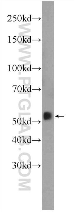 SMAD2 Rabbit anti-Human, Mouse, Rat, Polyclonal, Proteintech:Antibodies:Primary