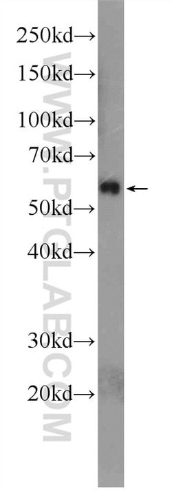 SMAD2 Rabbit anti-Human, Mouse, Rat, Polyclonal, Proteintech:Antibodies:Primary