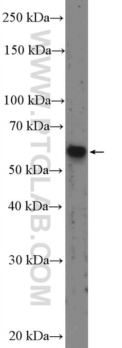 SMAD2 Rabbit anti-Human, Mouse, Rat, Polyclonal, Proteintech:Antibodies:Primary