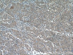 EDIL3 Rabbit anti-Human, Mouse, Rat, Polyclonal, Proteintech:Antibodies:Primary