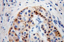 EDIL3 Rabbit anti-Human, Mouse, Rat, Polyclonal, Proteintech:Antibodies:Primary