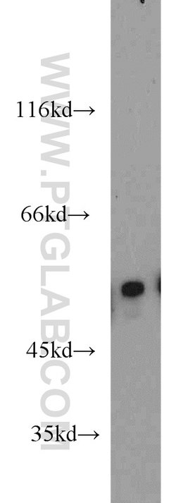 EDIL3 Rabbit anti-Human, Mouse, Rat, Polyclonal, Proteintech:Antibodies:Primary
