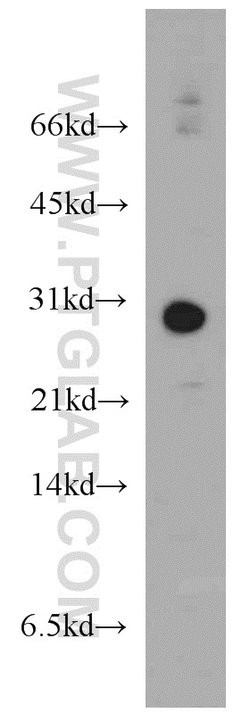 THAP1 Rabbit anti-Human, Mouse, Rat, Polyclonal, Proteintech 20 &mu;L;