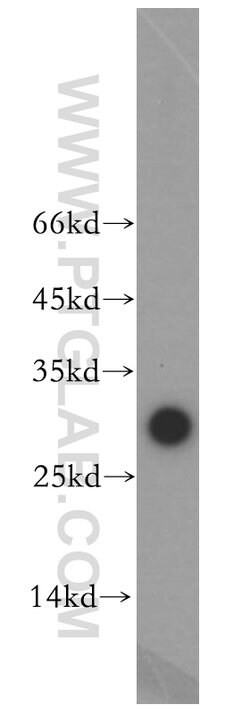 THAP1 Rabbit anti-Human, Mouse, Rat, Polyclonal, Proteintech 20 &mu;L;