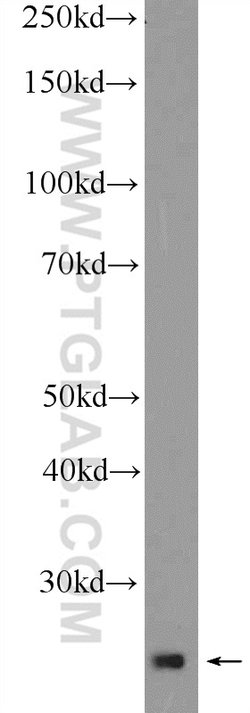 THAP1 Rabbit anti-Human, Mouse, Rat, Polyclonal, Proteintech 20 &mu;L;