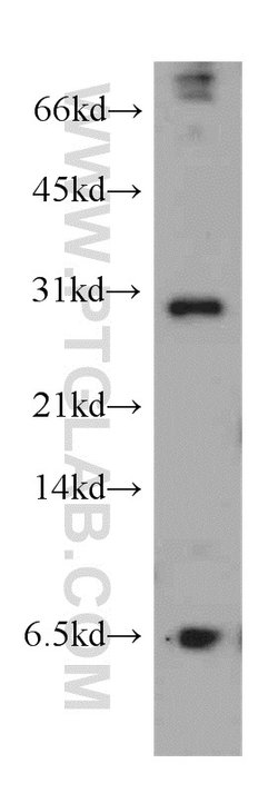 THAP1 Rabbit anti-Human, Mouse, Rat, Polyclonal, Proteintech 20 &mu;L;
