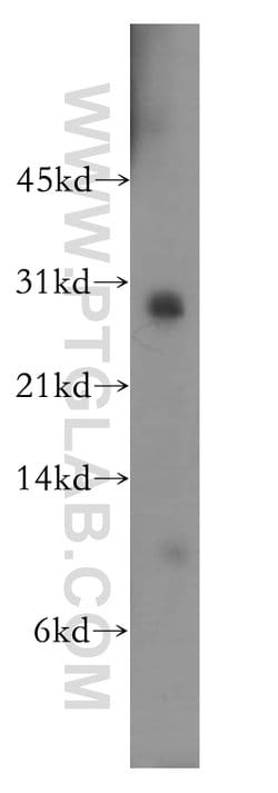 THAP1 Rabbit anti-Human, Mouse, Rat, Polyclonal, Proteintech 20 &mu;L;