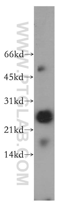 THAP1 Rabbit anti-Human, Mouse, Rat, Polyclonal, Proteintech 20 &mu;L;