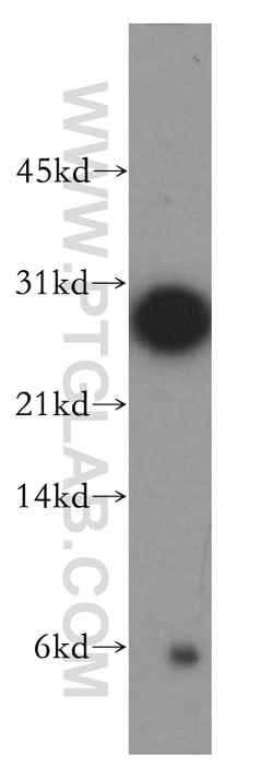 THAP1 Rabbit anti-Human, Mouse, Rat, Polyclonal, Proteintech 20 &mu;L;