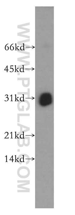 THAP1 Rabbit anti-Human, Mouse, Rat, Polyclonal, Proteintech 20 &mu;L;