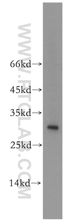 THAP1 Rabbit anti-Human, Mouse, Rat, Polyclonal, Proteintech 20 &mu;L;