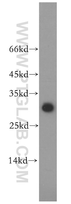 THAP1 Rabbit anti-Human, Mouse, Rat, Polyclonal, Proteintech 20 &mu;L;