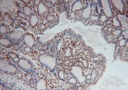 SAMHD1 Rabbit anti-Human, Mouse, Rat, Polyclonal, Proteintech:Antibodies:Primary