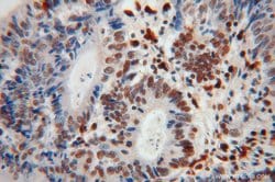 SAMHD1 Rabbit anti-Human, Mouse, Rat, Polyclonal, Proteintech:Antibodies:Primary