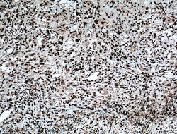 SAMHD1 Rabbit anti-Human, Mouse, Rat, Polyclonal, Proteintech:Antibodies:Primary