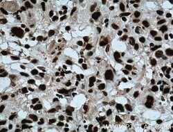 SAMHD1 Rabbit anti-Human, Mouse, Rat, Polyclonal, Proteintech:Antibodies:Primary