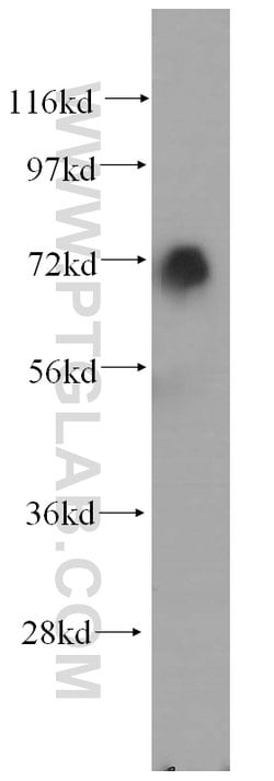 SAMHD1 Rabbit anti-Human, Mouse, Rat, Polyclonal, Proteintech:Antibodies:Primary