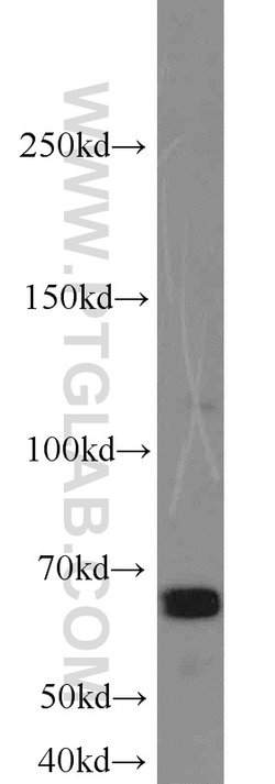 SAMHD1 Rabbit anti-Human, Mouse, Rat, Polyclonal, Proteintech:Antibodies:Primary