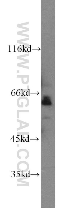 SAMHD1 Rabbit anti-Human, Mouse, Rat, Polyclonal, Proteintech:Antibodies:Primary
