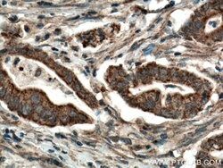 CDO1 Rabbit anti-Human, Mouse, Rat, Polyclonal, Proteintech:Antibodies:Primary