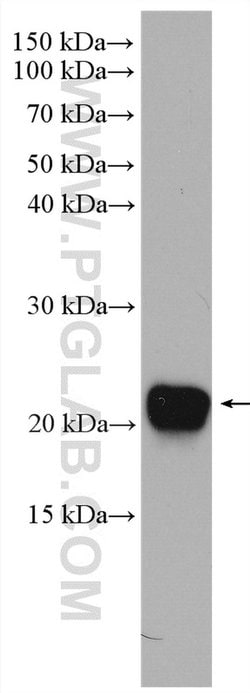 CDO1 Rabbit anti-Human, Mouse, Rat, Polyclonal, Proteintech:Antibodies:Primary