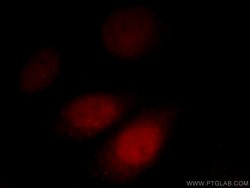 AKAP7 Rabbit anti-Human, Mouse, Rat, Polyclonal, Proteintech:Antibodies:Primary