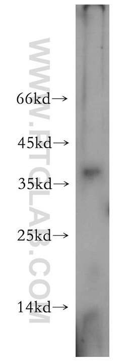 AKAP7 Rabbit anti-Human, Mouse, Rat, Polyclonal, Proteintech:Antibodies:Primary