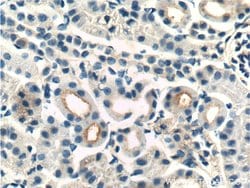 Integrin beta-1 Rabbit anti-Human, Mouse, Rat, Polyclonal, Proteintech:Antibodies:Primary