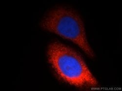 CTBS Rabbit anti-Human, Mouse, Rat, Polyclonal, Proteintech 150 &mu;L;