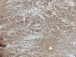 CTBS Rabbit anti-Human, Mouse, Rat, Polyclonal, Proteintech 150 &mu;L;