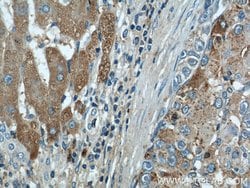 CTBS Rabbit anti-Human, Mouse, Rat, Polyclonal, Proteintech 150 &mu;L;