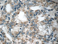 CTBS Rabbit anti-Human, Mouse, Rat, Polyclonal, Proteintech 150 &mu;L;