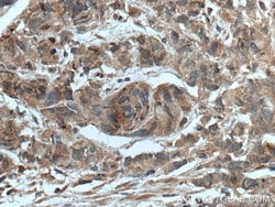 CTBS Rabbit anti-Human, Mouse, Rat, Polyclonal, Proteintech 150 &mu;L;