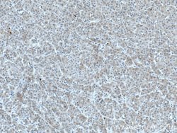 CTBS Rabbit anti-Human, Mouse, Rat, Polyclonal, Proteintech 150 &mu;L;