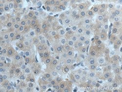 CTBS Rabbit anti-Human, Mouse, Rat, Polyclonal, Proteintech 150 &mu;L;