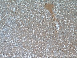 CTBS Rabbit anti-Human, Mouse, Rat, Polyclonal, Proteintech 150 &mu;L;