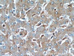 CTBS Rabbit anti-Human, Mouse, Rat, Polyclonal, Proteintech 150 &mu;L;