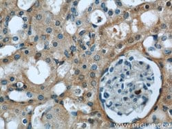CTBS Rabbit anti-Human, Mouse, Rat, Polyclonal, Proteintech 150 &mu;L;