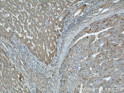 CTBS Rabbit anti-Human, Mouse, Rat, Polyclonal, Proteintech 150 &mu;L;