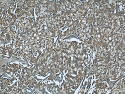 CTBS Rabbit anti-Human, Mouse, Rat, Polyclonal, Proteintech 150 &mu;L;