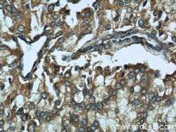 CTBS Rabbit anti-Human, Mouse, Rat, Polyclonal, Proteintech 150 &mu;L;