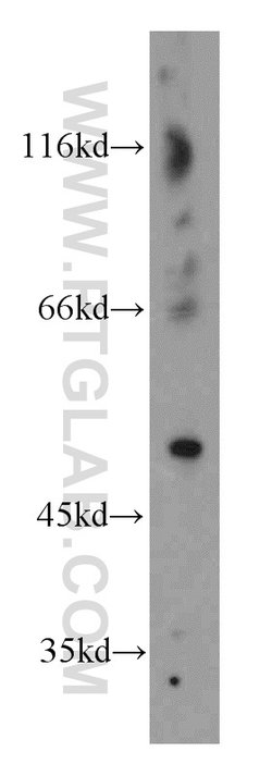CTBS Rabbit anti-Human, Mouse, Rat, Polyclonal, Proteintech 150 &mu;L;
