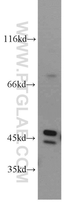 CTBS Rabbit anti-Human, Mouse, Rat, Polyclonal, Proteintech 150 &mu;L;