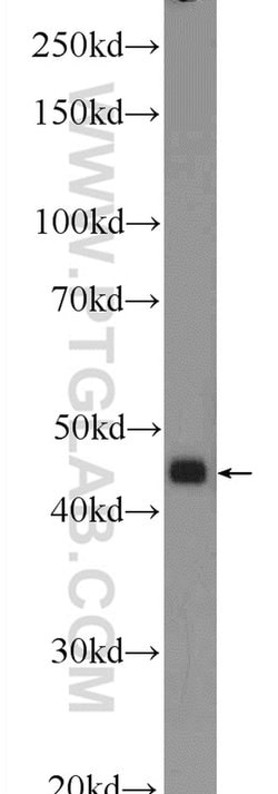 CTBS Rabbit anti-Human, Mouse, Rat, Polyclonal, Proteintech 150 &mu;L;