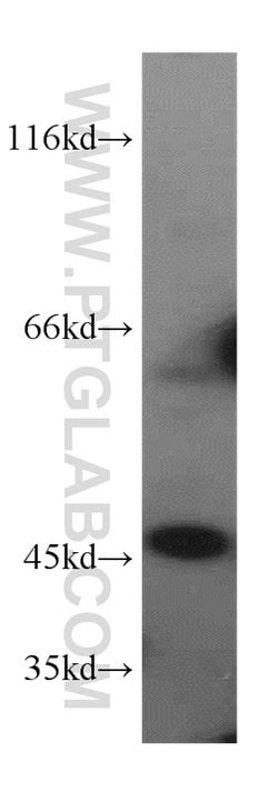 CTBS Rabbit anti-Human, Mouse, Rat, Polyclonal, Proteintech 150 &mu;L;
