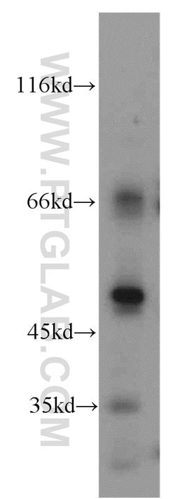 CTBS Rabbit anti-Human, Mouse, Rat, Polyclonal, Proteintech 150 &mu;L;