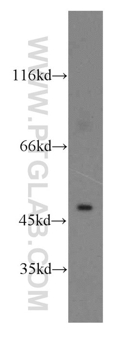 CTBS Rabbit anti-Human, Mouse, Rat, Polyclonal, Proteintech 150 &mu;L;
