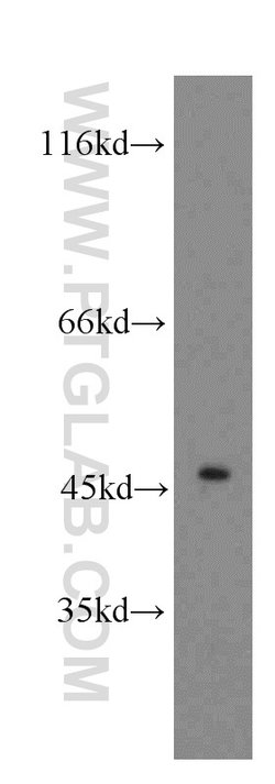 CTBS Rabbit anti-Human, Mouse, Rat, Polyclonal, Proteintech 150 &mu;L;